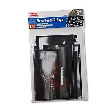 Fixed Bones X Ray - louisekool