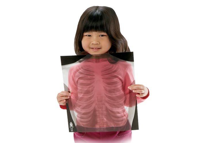 Human X-Rays - Set of 18 - louisekool