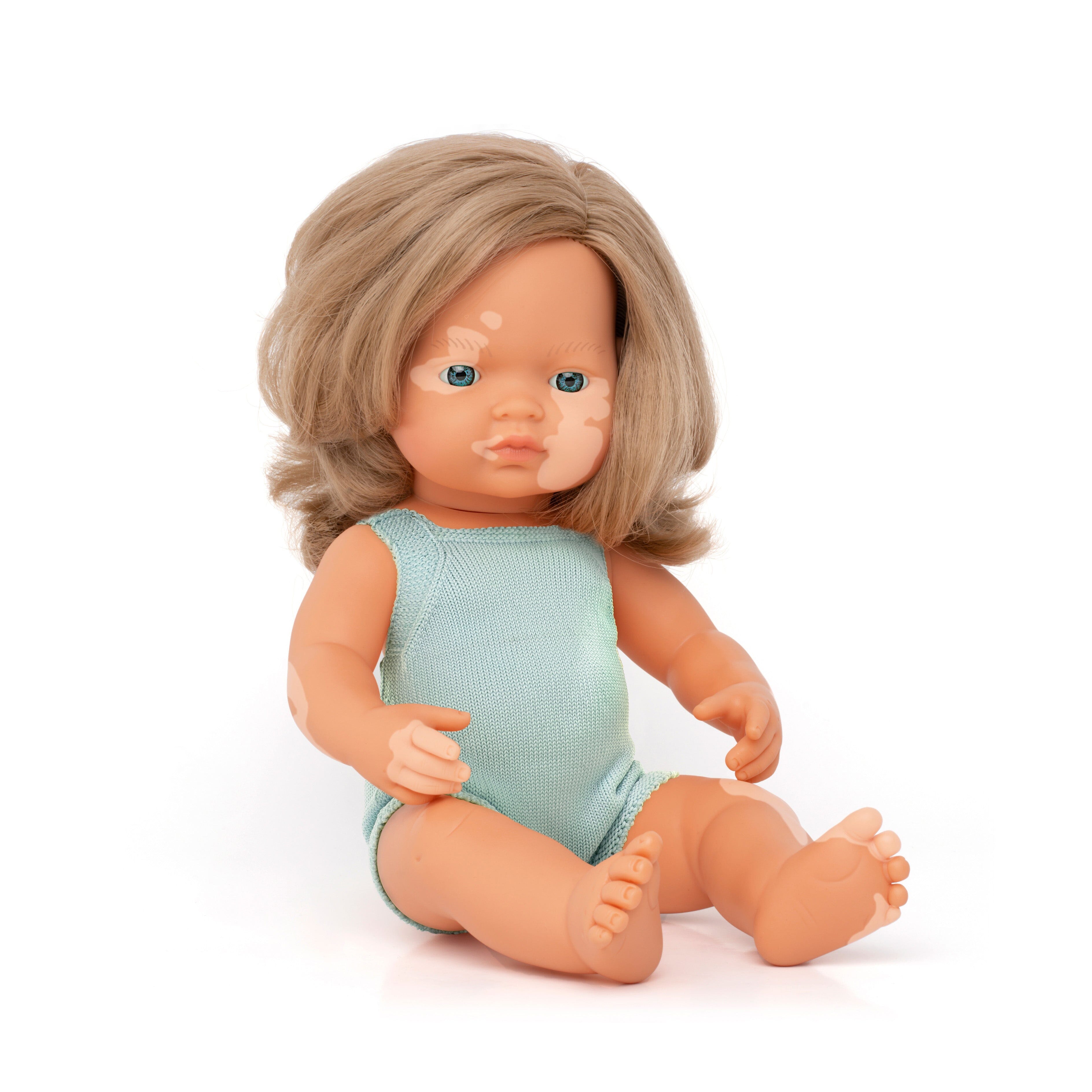 Doll With Vitiligo - louisekool