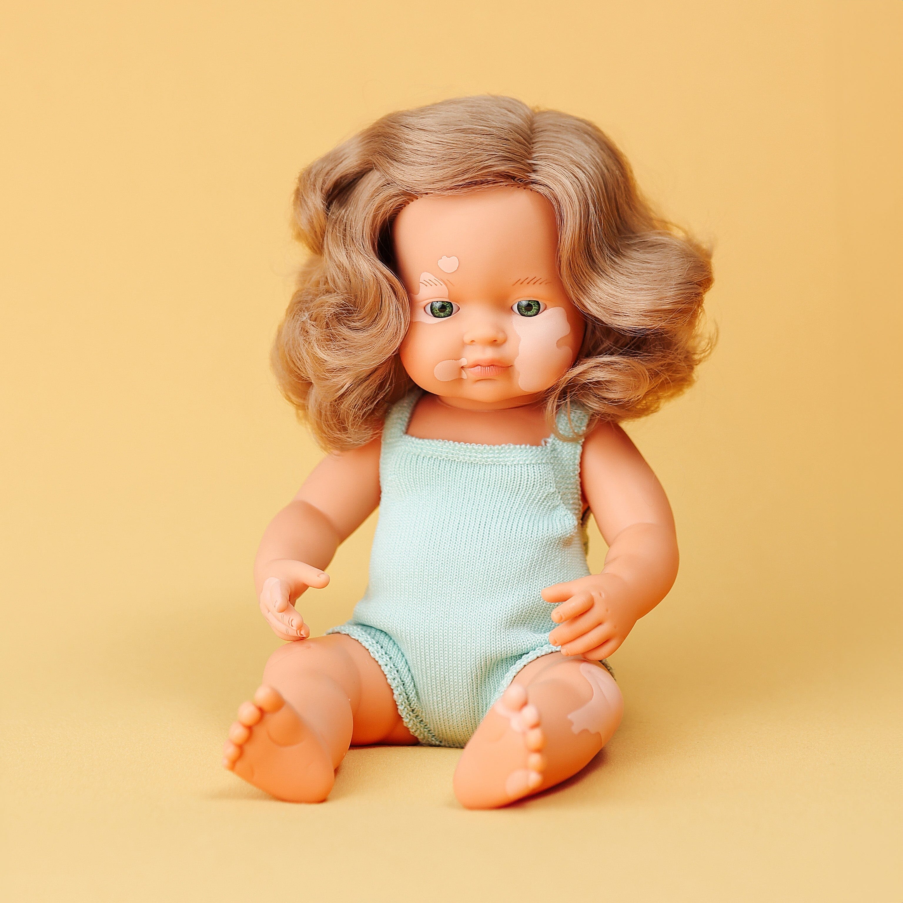 Doll With Vitiligo - louisekool